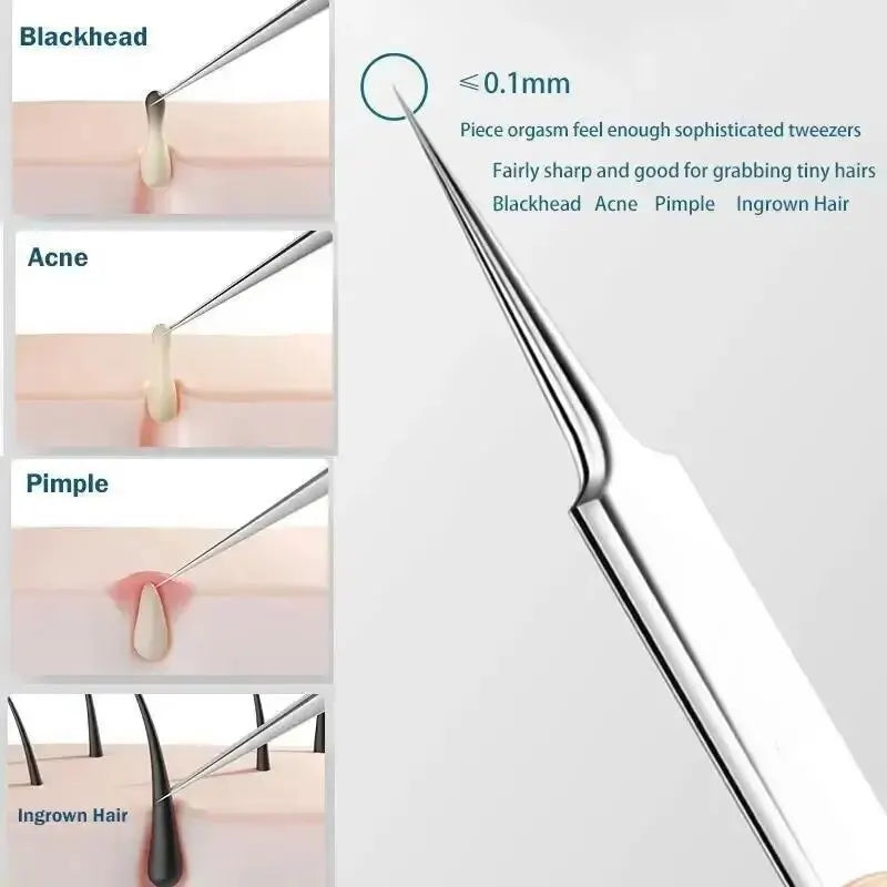 11Pcs Ingrown Hair Tweezers Acne Blackhead Removal