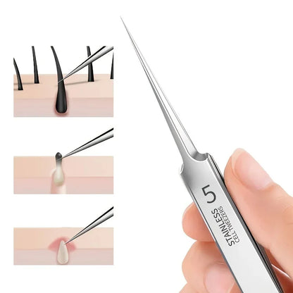 1 Pack Extra Fine No. 5 Cellular Acne Blackhead Tweezers