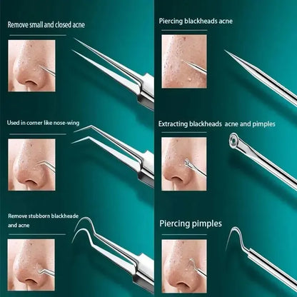 11Pcs Ingrown Hair Tweezers Acne Blackhead Removal